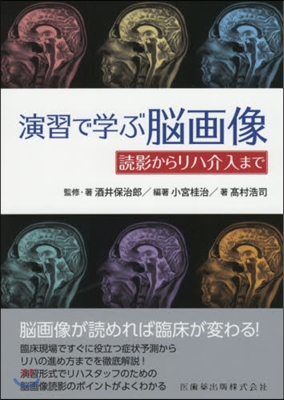 演習で學ぶ腦畵像 讀影からリハ介入まで