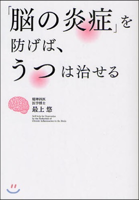 「腦の炎症」を防げば,うつは治せる