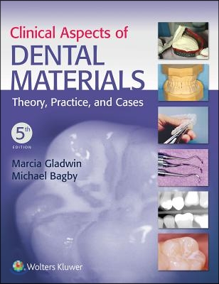 Clinical Aspects of Dental Materials