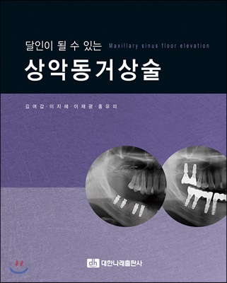 달인이 될 수 있는 상악동거상술