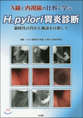 H.pylori胃炎診斷 新時代の胃がん