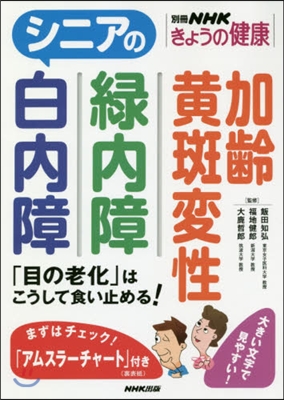 シニアの白內障綠內障加齡黃斑變性 