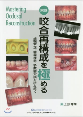 實踐咬合再構成を極める 齒列不正,齒周疾