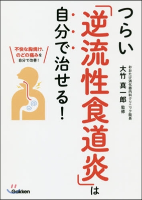 つらい「逆流性食道炎」は自分で治せる!