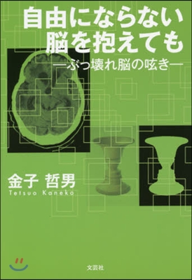 自由にならない腦を抱えても－ぶっ壞れ腦の