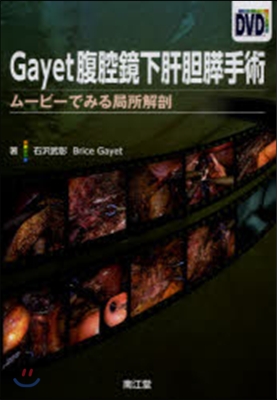 Gayet腹腔鏡下肝膽臟手術 DVD付