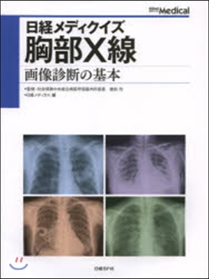 胸部X線 畵像診斷の基本