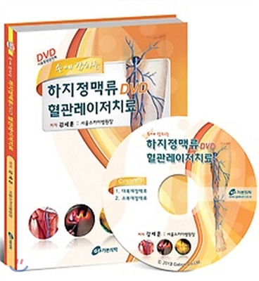 손에 잡히는 하지정맥류 DVD 혈관레이저치료