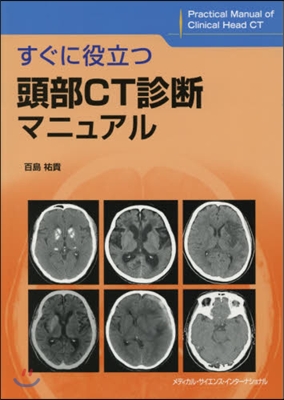 すぐに役立つ頭部CT診斷マニュアル