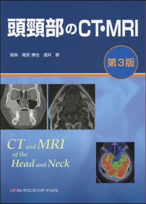 頭頸部のCT.MRI 第3版