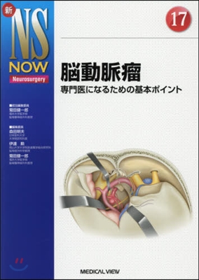 腦動脈瘤 專門醫になるための基本ポイント