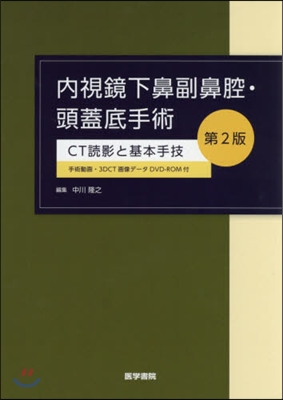 內視鏡下鼻副鼻腔.頭蓋底手術 第2版