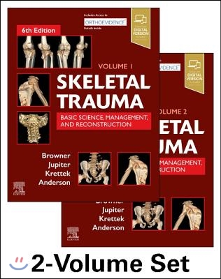 Skeletal Trauma