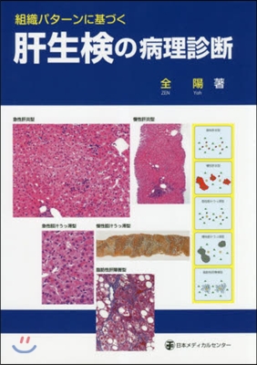 組織パタ-ンに基づく肝生檢の病理診斷