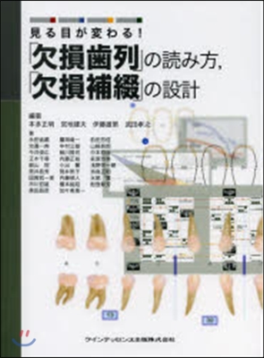 「欠損齒列」の讀み方，「欠損補綴」の設計