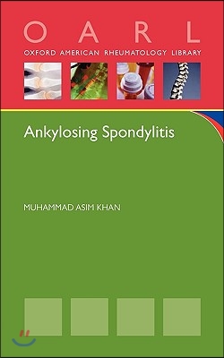 Ankylosing Spondylitis