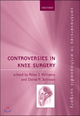 Controversies in Knee Surgery