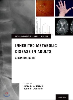 Inherited Metabolic Disease in Adults