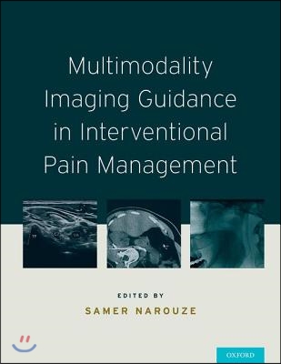 Multimodality Imaging Guidance in Interventional Pain Management