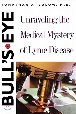 Bull&#39;s-Eye: Unraveling the Medical Mystery of Lyme Disease