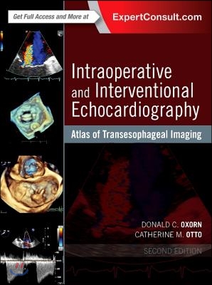 Intraoperative and Interventional Echocardiography