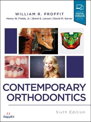 Contemporary Orthodontics, 6/E