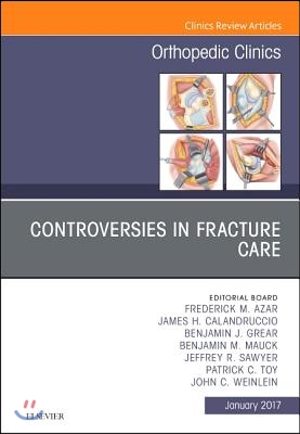 Controversies in Fracture Care, an Issue of Orthopedic Clinics: Volume 48-1