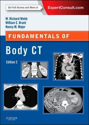 Fundamentals of Body CT: Expert Consult - Online and Print