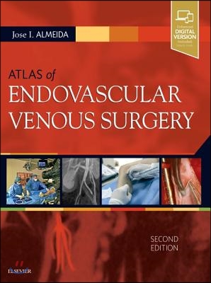 Atlas of Endovascular Venous Surgery, 2/E