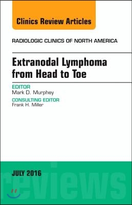 Extranodal Lymphoma from Head to Toe, an Issue of Radiologic Clinics of North America: Volume 54-4