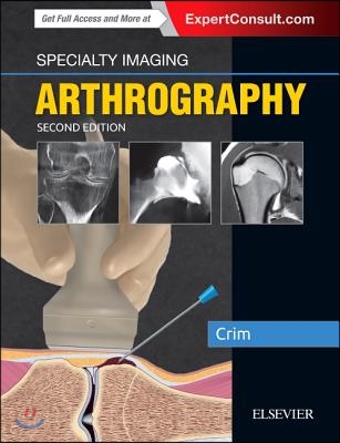 Arthrography