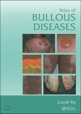 Atlas of Bullous Diseases