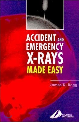 Accident and Emergency X-Rays Made Easy: Accident and Emergency X-Rays Made Easy