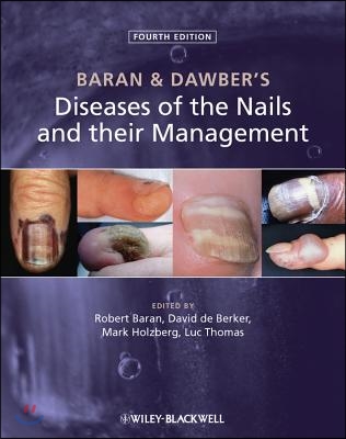 Baran & Dawber's Diseases of the Nails and Their Management