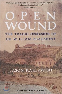 Open Wound: The Tragic Obsession of Dr. William Beaumont