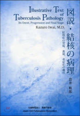 圖說.結核の病理 結核症の發病,進展,重