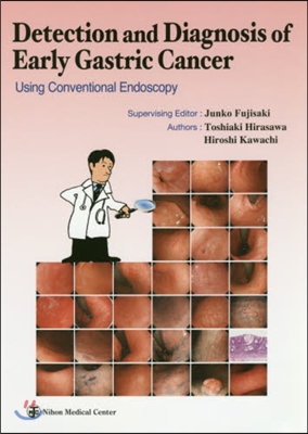 Detection and Diagnosis of Early Gastric