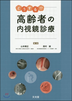 どうする!?高齡者の內視鏡診療