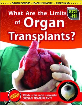 What Are the Limits of Organ Transplants?