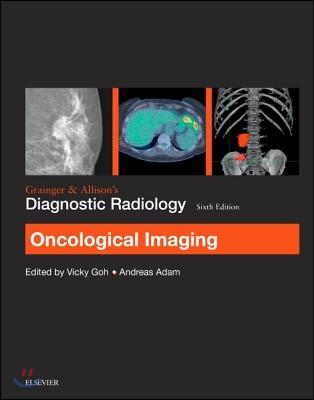 Grainger &amp; Allison&#39;s Diagnostic Radiology: Oncological Imaging