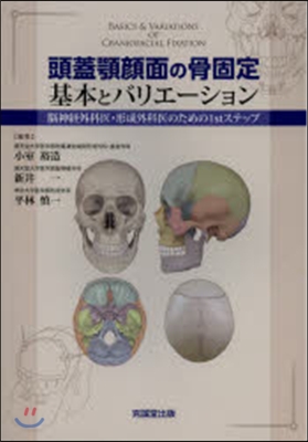 頭蓋顎顔面の骨固定 基本とバリエ-ション