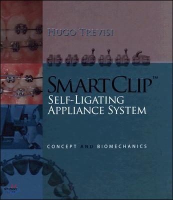 SmartClip Self-Ligating Appliance System