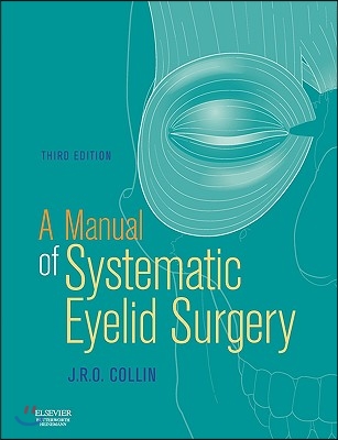 A Manual of Systematic Eyelid Surgery