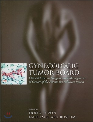 Gynecologic Tumor Board