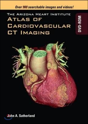 The Arizona Heart Institute Atlas of Cardiovascular Ct Imaging