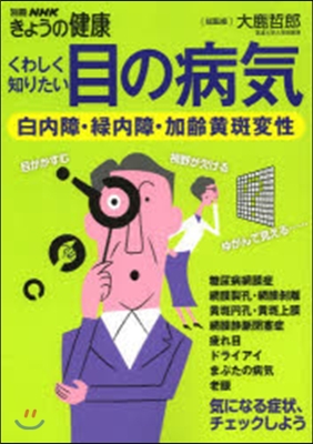 くわしく知りたい目の病氣 白內障.綠內障