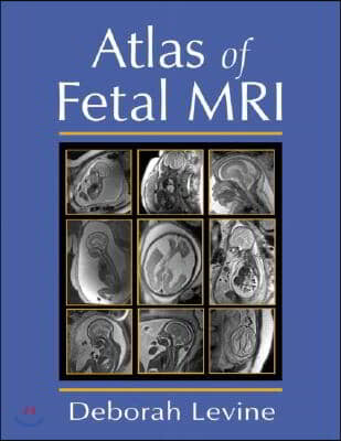 Atlas of Fetal MRI