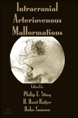 Intracranial Arteriovenous Malformations