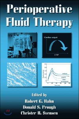 Perioperative Fluid Therapy