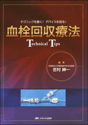 血栓回收療法Technical Tips